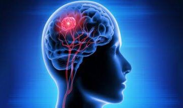 آپ کی 40 اور 50 کی دہائیوں میں یہ سادہ عادت الزائمر میں تاخیر کر سکتی ہے۔