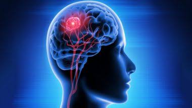 آپ کی 40 اور 50 کی دہائیوں میں یہ سادہ عادت الزائمر میں تاخیر کر سکتی ہے۔