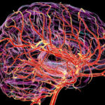 دماغ کی یہ پوشیدہ نبض ڈیمنشیا کی پیش گوئی کر سکتی ہے۔