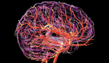 دماغ کی یہ پوشیدہ نبض ڈیمنشیا کی پیش گوئی کر سکتی ہے۔