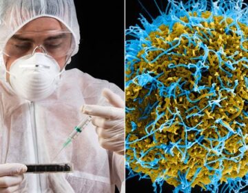 سائنسدانوں نے نامعلوم، مہلک بیماریوں کی وجہ تلاش کی۔