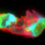 سائنسدانوں نے طویل COVID میں خون کے پوشیدہ نمونے کو بے نقاب کیا۔