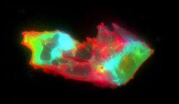 سائنسدانوں نے طویل COVID میں خون کے پوشیدہ نمونے کو بے نقاب کیا۔