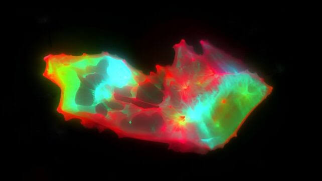 سائنسدانوں نے طویل COVID میں خون کے پوشیدہ نمونے کو بے نقاب کیا۔