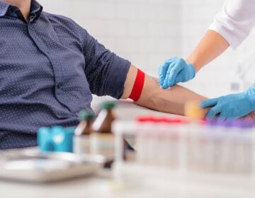 جوان خون الزائمر کے خلاف طاقتور حفاظتی اثرات دکھاتا ہے۔