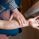 آپ کی جلد آپ کو دماغی صحت کی پریشانی کے بارے میں خبردار کر سکتی ہے۔