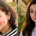 ہانیہ عامر کی کزن نے اس کی ڈمپل پلاسٹی کی حقیقت سامنے لا دی