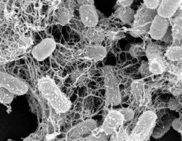 سائنسدانوں نے قدرتی پروٹین دریافت کیا جو نقصان دہ بیکٹیریا کو پھنس کر مار دیتا ہے۔