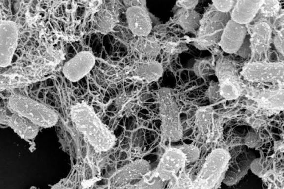 سائنسدانوں نے قدرتی پروٹین دریافت کیا جو نقصان دہ بیکٹیریا کو پھنس کر مار دیتا ہے۔