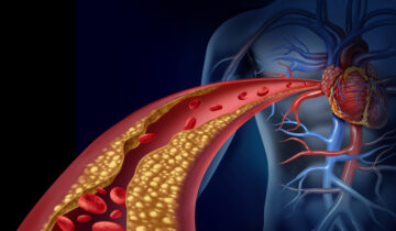 ہائی کولیسٹرول مستقبل میں دل کی بیماری کے خطرے کی پیش گوئی کر سکتا ہے، یہاں تک کہ صحت مند خواتین میں بھی
