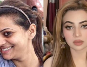 بینیتا ڈیوڈ کا رنگ گورا کرنے والے انجیکشن لگوانے سے متعلق سچا اعتراف