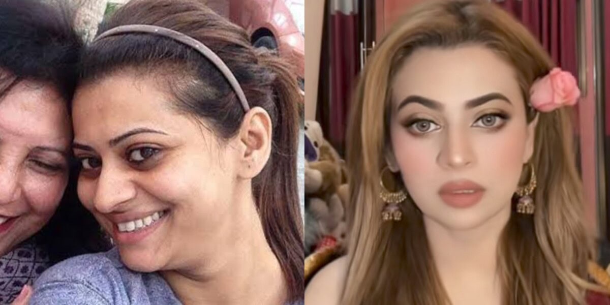 بینیتا ڈیوڈ کا رنگ گورا کرنے والے انجیکشن لگوانے سے متعلق سچا اعتراف