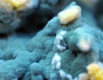 ایک سادہ خون کا پروٹین ایک مہلک فنگل بیماری کے علاج کو تبدیل کر سکتا ہے۔