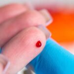 یہ نیا بلڈ ٹیسٹ ٹیومر ظاہر ہونے سے پہلے کینسر کا پتہ لگا سکتا ہے۔