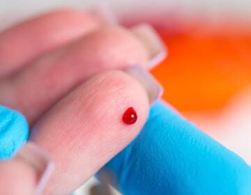 یہ نیا بلڈ ٹیسٹ ٹیومر ظاہر ہونے سے پہلے کینسر کا پتہ لگا سکتا ہے۔