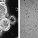 کیا ایک عام وٹامن انتہائی جارحانہ دماغی کینسر سے لڑ سکتا ہے؟