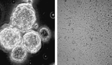 کیا ایک عام وٹامن انتہائی جارحانہ دماغی کینسر سے لڑ سکتا ہے؟