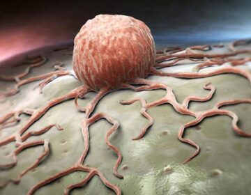 لبلبے کے کینسر کا نیا علاج ٹیومر کو ختم کرتا ہے اور منشیات کے خلاف مزاحمت کو روکتا ہے۔