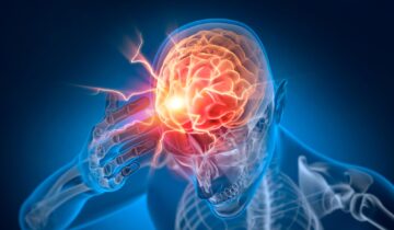 اسٹینفورڈ کے سائنسدانوں نے دماغ کے چھپے ہوئے سرکٹ کو دریافت کیا جو دائمی درد کو ایندھن دیتا ہے۔