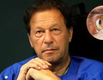 عمران کو فالو اپ علاج کے لیے پمز لے جایا گیا، پانچویںبل بار آنکھ کا آپریشن ہوا۔